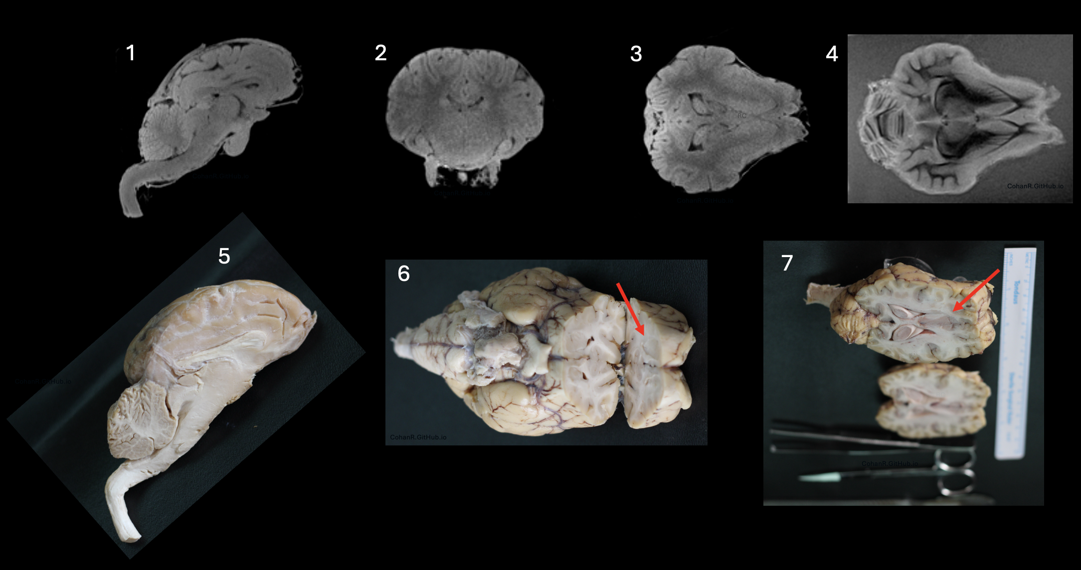 Neuroanatomy: Brain Dissection | Ovine Brain Anatomy Quiz | Remy Cohan